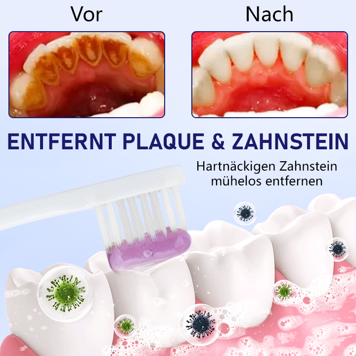 Ceoerty™ VenoSmile Bienengift Zahnreparatur-Zahnpasta 🦷✨