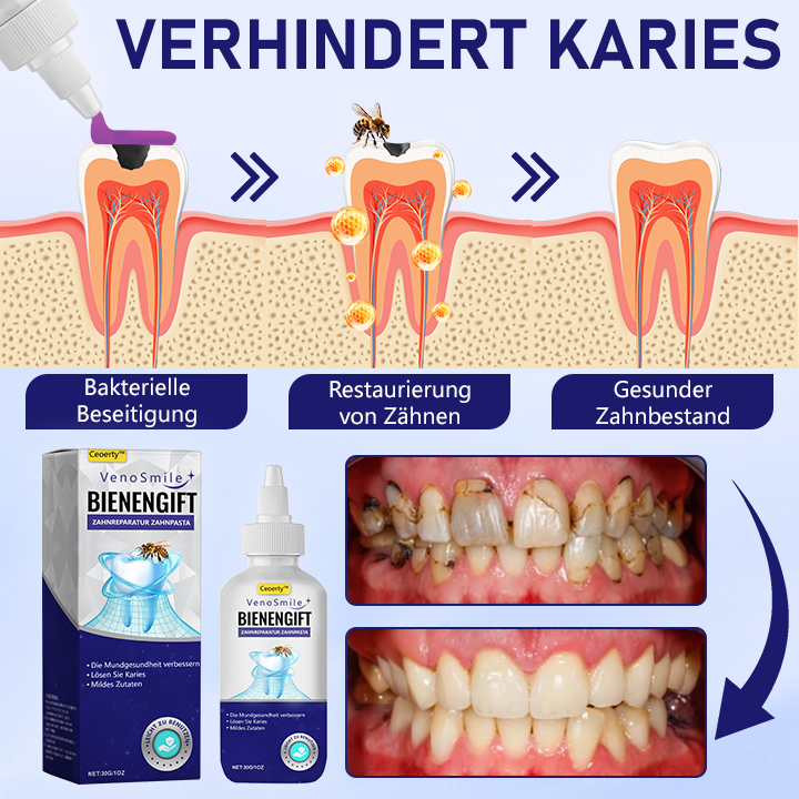 Ceoerty™ VenoSmile Bienengift Zahnreparatur-Zahnpasta 🦷✨